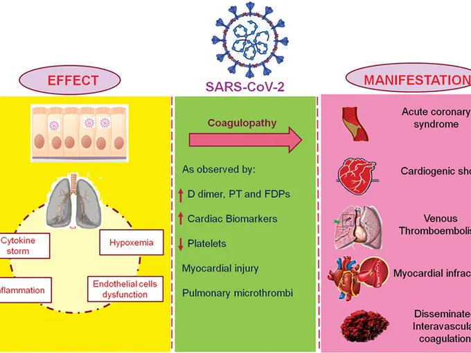 Article figure from TH open : companion journal to thrombosis and haemostasis (2022)